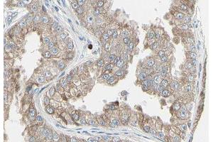 ABIN6278831 at 1/100 staining Human prostate tissue by IHC-P. (ADCY7 Antikörper  (Internal Region))