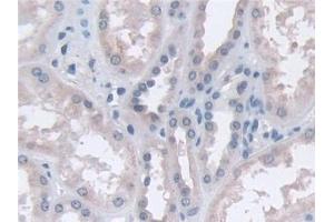 Immunohistochemistry (IHC) image for anti-Carboxypeptidase A4 (CPA4) (AA 55-421) antibody (ABIN7435982)