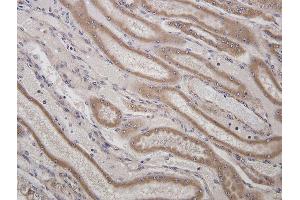 Immunohistochemistry (IHC) image for anti-Hydroxysteroid (11-Beta) Dehydrogenase 1 (HSD11B1) (AA 201-292) antibody (ABIN750913)
