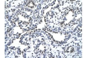 Rabbit Anti-ZNF212 antibody   Paraffin Embedded Tissue: Human Lung cell Cellular Data: alveolar cell of renal tubule Antibody Concentration: 4. (ZNF212 Antikörper  (N-Term))