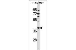 TBCC Antibody (N-term ) (ABIN657398 and ABIN2846438) western blot analysis in mouse spleen tissue lysates (35 μg/lane). (TBCC Antikörper  (N-Term))