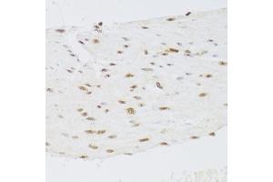 Immunohistochemistry of paraffin-embedded human stomach using CSRP3 Antibody (ABIN2562048) at dilution of 1:100 (40x lens). (CSRP3 Antikörper)