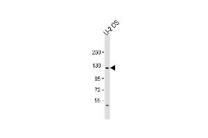 Anti-LIFR Antibody (C-term) at 1:2000 dilution + U-2OS whole cell lysate Lysates/proteins at 20 μg per lane. (LIFR Antikörper  (C-Term))