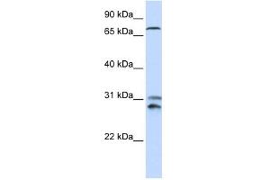 TLK2 antibody used at 1 ug/ml to detect target protein. (TLK2 Antikörper  (N-Term))