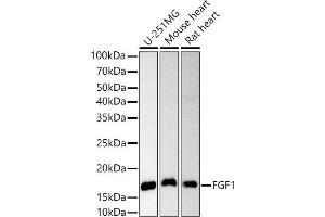 Western blot analysis of extracts of various cell lines, using FGF1 antibody (ABIN3021072, ABIN3021073, ABIN3021074 and ABIN6213939) at 1:1000 dilution. (FGF1 Antikörper  (AA 16-155))