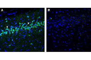 Expression of NPFFR1 in rat hippocampus. (NPFFR1 Antikörper  (Extracellular))