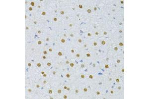 Immunohistochemistry of paraffin-embedded rat liver using SNRNP70 antibody. (SNRNP70 Antikörper  (AA 150-250))