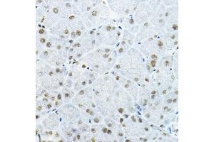 Immunohistochemistry of paraffin-embedded mouse pancreas using GB Rabbit pAb (ABIN6127943, ABIN6140978, ABIN6140979 and ABIN6225075) at dilution of 1:100 (40x lens). (GATAD2B Antikörper  (AA 1-120))