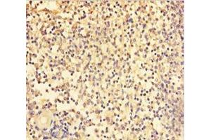 Immunohistochemistry of paraffin-embedded human spleen tissue using ABIN7172243 at dilution of 1:100 (TRAF5 Antikörper  (AA 1-557))