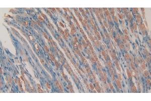 Detection of CHEM in Mouse Stomach Tissue using Polyclonal Antibody to Chemerin (CHEM) (Chemerin Antikörper  (AA 21-155))