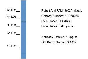 Western Blotting (WB) image for anti-Family with Sequence Similarity 120C (FAM120C) (N-Term) antibody (ABIN2788566) (FAM120C Antikörper  (N-Term))