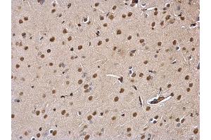 IHC-P Image DDB1 antibody detects DDB1 protein at nucleus and cytosol on rat fore brain by immunohistochemical analysis. (DDB1 Antikörper  (C-Term))