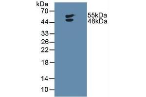Detection of LTbR in Human U-87MG Cells using Polyclonal Antibody to Lymphotoxin Beta Receptor (LTbR) (LTBR Antikörper  (AA 66-215))
