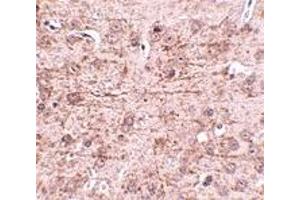 Immunohistochemistry (IHC) image for anti-Zinc Finger and BTB Domain Containing 1 (ZBTB1) (Middle Region) antibody (ABIN1031169) (ZBTB1 Antikörper  (Middle Region))