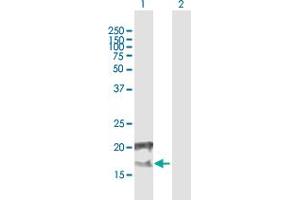 Western Blot analysis of CCDC126 expression in transfected 293T cell line by CCDC126 MaxPab polyclonal antibody. (CCDC126 Antikörper  (AA 1-140))