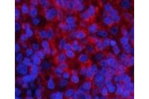 Immunofluorescence analysis of Rat spleen tissue using Phospho-PI 3 kinase p85 alpha /gamma (Tyr467/199) Polyclonal Antibody at dilution of 1:200 (PI3K p85 alpha/gamma Antikörper  (pTyr199, pTyr467))