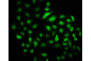 Immunofluorescence staining of Hela cells with ABIN7150197 at 1:133, counter-stained with DAPI. (DMAP1 Antikörper  (AA 250-300))