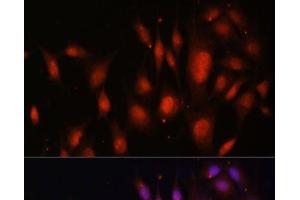 Immunofluorescence analysis of NIH/3T3 cells using TFEB Polyclonal Antibody at dilution of 1:100. (TFEB Antikörper)