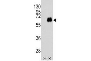 Western blot analysis of Myc antibody and 293 cell lysate (2 ug/lane) either nontransfected (Lane 1) or transiently transfected with the MYC gene (2).