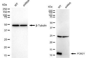 Western blotting analysis using PCBD1 antibody (ABIN7800060).