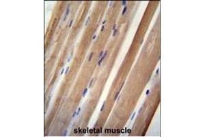 INB antibody (C-term) (ABIN654447 and ABIN2844181) immunohistochemistry analysis in formalin fixed and paraffin embedded human skeletal muscle followed by peroxidase conjugation of the secondary antibody and DAB staining. (INPP5B Antikörper  (C-Term))