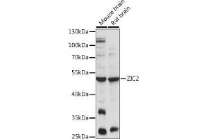 Western blot analysis of extracts of various cell lines, using ZIC2 antibody (ABIN7271432) at 1:1000 dilution. (ZIC2 Antikörper  (AA 1-220))
