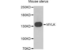 Western blot analysis of extracts of Mouse uterus, using MYLK antibody. (MYLK Antikörper)