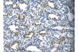 Rabbit Anti-SUV39H1 Antibody       Paraffin Embedded Tissue:  Human alveolar cell   Cellular Data:  Epithelial cells of renal tubule  Antibody Concentration:   4. (SUV39H1 Antikörper  (C-Term))