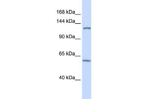 WB Suggested Anti-PHF12 Antibody Titration:  0. (PHF12 Antikörper  (C-Term))