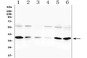 Western blot analysis of ORAI1 using anti-ORAI1 antibody (ABIN7601852).