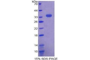 SDS-PAGE (SDS) image for Sulfotransferase Family, Cytosolic, 1A, Phenol-Preferring, Member 1 (SULT1A1) (AA 3-285) protein (His tag) (ABIN2126272)