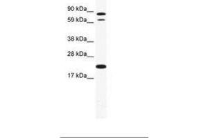Image no. 1 for anti-Zinc Finger Protein 287 (ZNF287) (AA 104-153) antibody (ABIN202903) (ZNF287 Antikörper  (AA 104-153))