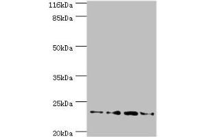 Western blot All lanes: Fxn antibody at 2 μg/mL Lane 1: HepG2 whole cell lysate Lane 2: Hela whole cell lysate Lane 3: Mouse brain tissue Lane 4: Jurkat whole cell lysate Secondary Goat polyclonal to rabbit IgG at 1/10000 dilution Predicted band size: 23 kDa Observed band size: 23 kDa (Frataxin Antikörper  (AA 78-207))