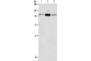Gel: 8 % SDS-PAGE, Lysate: 40 μg, Lane 1-3: Hela cells, Jurkat cells, NIH/3T3 cells, Primary antibody: ABIN7128400(ANAPC2 Antibody) at dilution 1/200, Secondary antibody: Goat anti rabbit IgG at 1/8000 dilution, Exposure time: 40 seconds (ANAPC2 Antikörper)