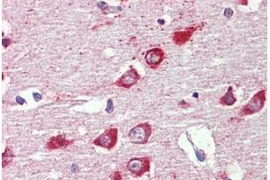 Brain, cortex, Human: Formalin-Fixed, Paraffin-Embedded (FFPE)