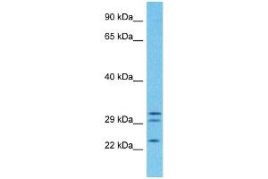 Host:  Rabbit  Target Name:  PGRC2  Sample Type:  Fetal Lung lysates  Antibody Dilution:  1ug/ml (PGRMC1 Antikörper  (C-Term))