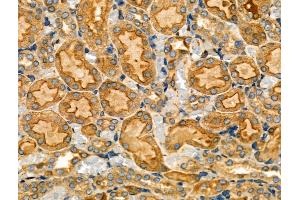 ABIN6257018 and ABIN6274200 at 1/100 staining Rat kidney tissue by IHC-P. (PRKACG Antikörper  (N-Term))