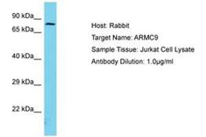 Image no. 1 for anti-Armadillo Repeat Containing 9 (ARMC9) (AA 90-139) antibody (ABIN6750691) (ARMC9 Antikörper  (AA 90-139))