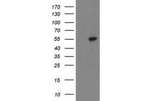 Western Blotting (WB) image for anti-ATPase, H+ Transporting, Lysosomal 56/58kDa, V1 Subunit B1 (ATP6V1B1) antibody (ABIN1496774) (ATP6V1B1 Antikörper)