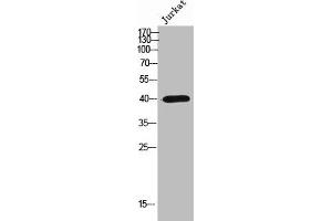 Western Blot analysis of Jurkat cells using Olfactory receptor 2AP1 Polyclonal Antibody (OR2AP1 Antikörper  (C-Term))