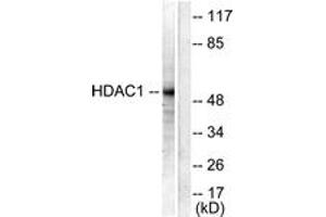 Western blot analysis of extracts from NIH-3T3 cells, using HDAC1 Antibody. (HDAC1 Antikörper  (AA 433-482))