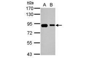 Image no. 2 for anti-EPS8-Like 2 (EPS8L2) (AA 402-699) antibody (ABIN1498054)