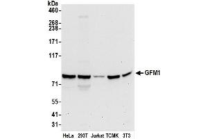 anti-G-Elongation Factor, Mitochondrial 1 (GFM1) (AA 525-575) antibody