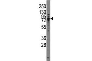 Western blot analysis of TRPV3 antibody and HL-60 lysate.