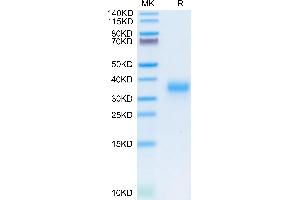 Human CD74 on Tris-Bis PAGE under reduced condition. (CD74 Protein (AA 73-232) (His tag))