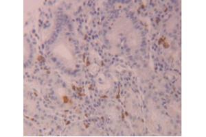 IHC-P analysis of Human Stomach Tissue, with DAB staining. (FLG2 Antikörper  (AA 1222-1368))