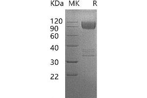 Western Blotting (WB) image for CD86 (CD86) protein (Fc Tag) (ABIN7320949)