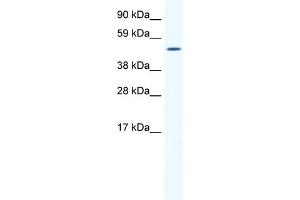 WB Suggested Anti-SP1 Antibody Titration:  1. (SP1 Antikörper  (Middle Region))