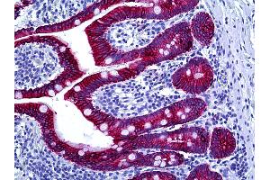 Anti-Cytokeratin Type II antibody IHC of human intestine. (Keratin Basic Antikörper)