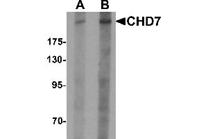 Western blot analysis of CHD7 in SK-N-SH cell lysate with CHD7 antibody at (A) 1 and (B) 2 µg/mL.